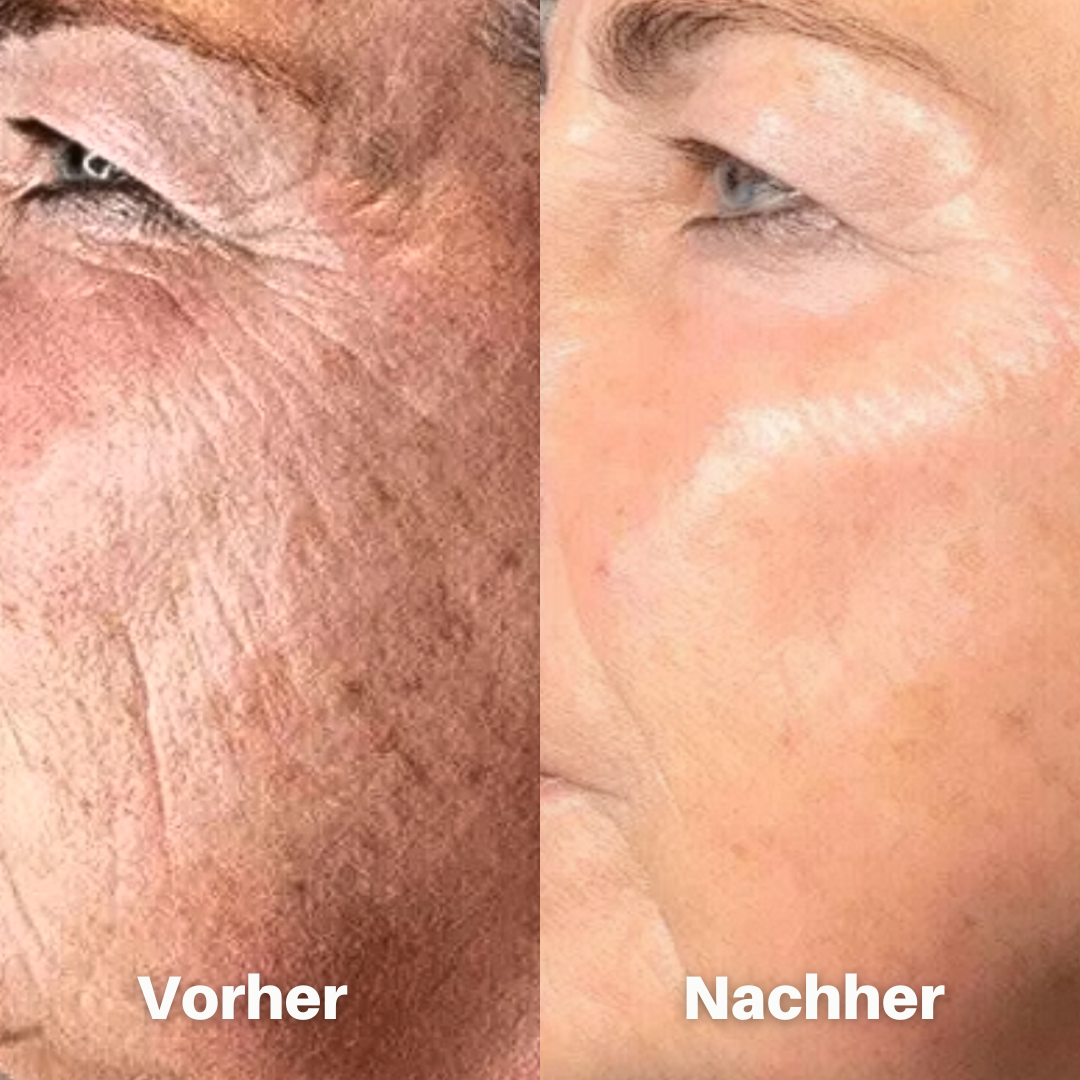 Julie™ • Anti-Aging-Serum