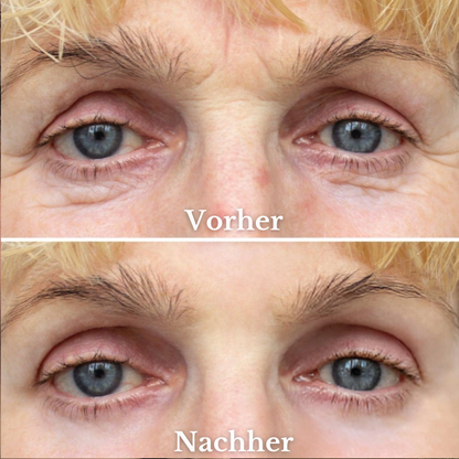 Julie™ • Anti-Aging-Serum
