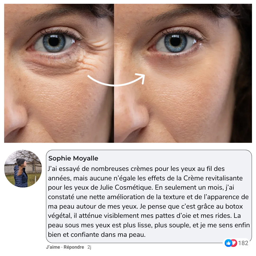 Julie™ • Creme gegen Augenringe & Tränensäcke