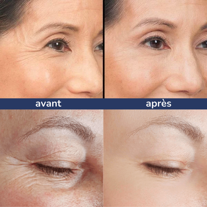 Julie™ • Creme gegen Augenringe & Tränensäcke