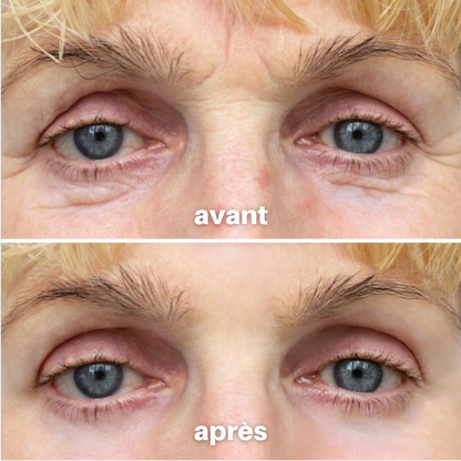Julie™ • Creme gegen Augenringe & Tränensäcke