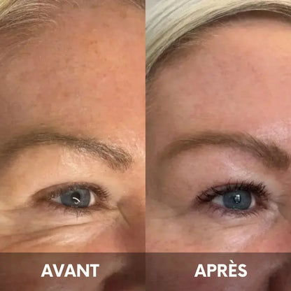 Julie™ • Creme gegen Augenringe & Tränensäcke