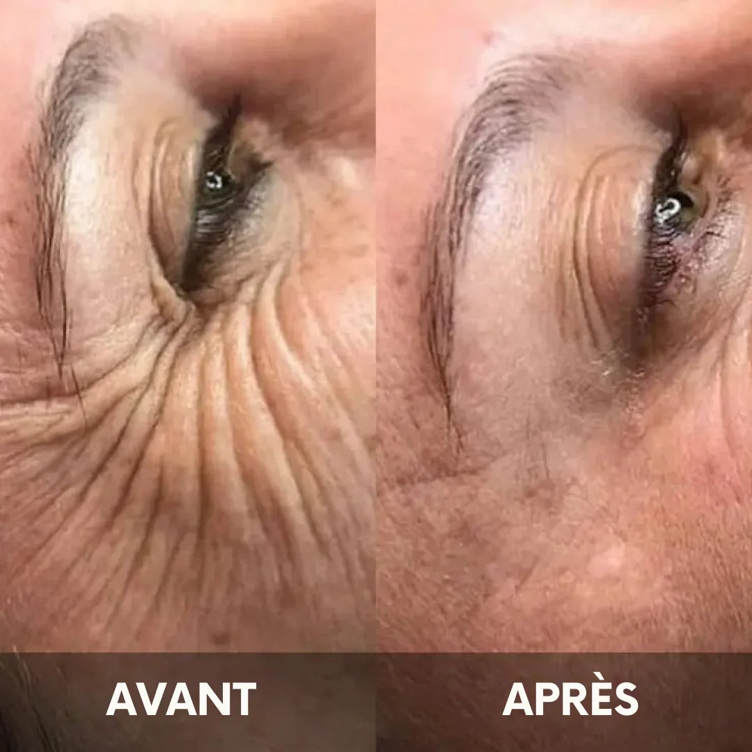 Julie™ • Creme gegen Augenringe & Tränensäcke