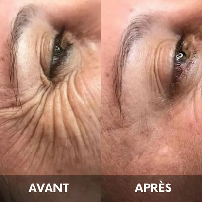 Julie™ • Creme gegen Augenringe & Tränensäcke