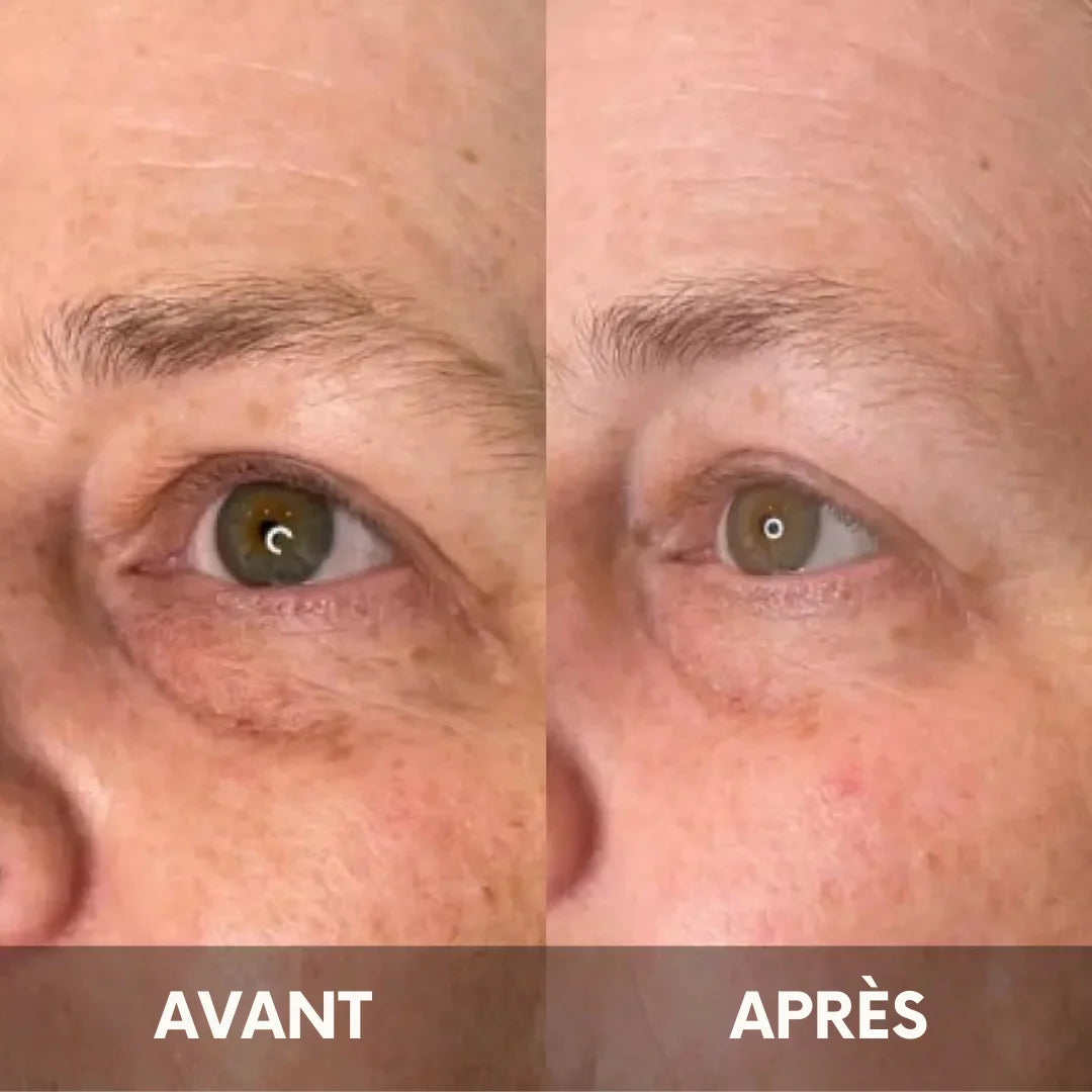 Julie™ • Creme gegen Augenringe & Tränensäcke