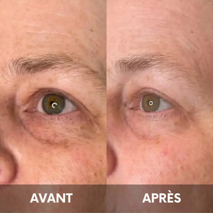 Julie™ • Creme gegen Augenringe & Tränensäcke