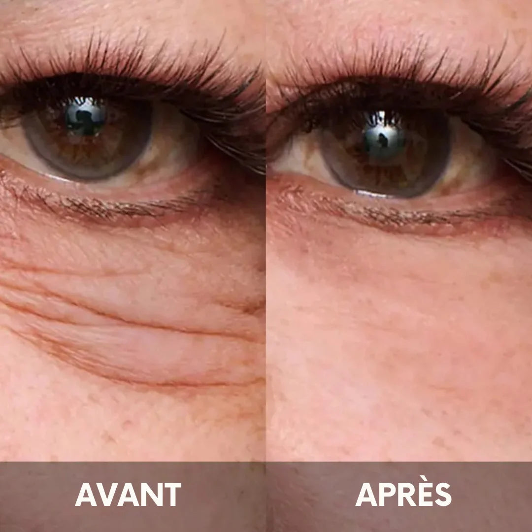 Julie™ • Creme gegen Augenringe & Tränensäcke