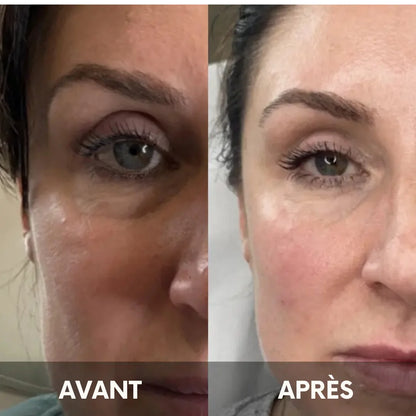 Julie™ • Creme gegen Augenringe & Tränensäcke